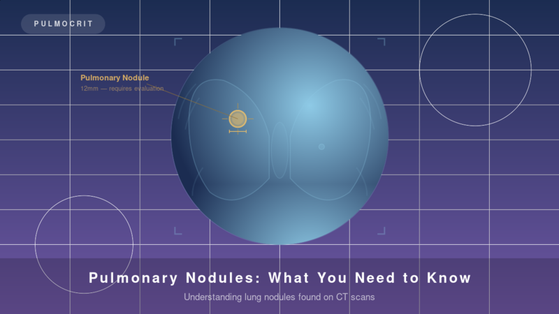 Pulmonary nodule CT scan lung health