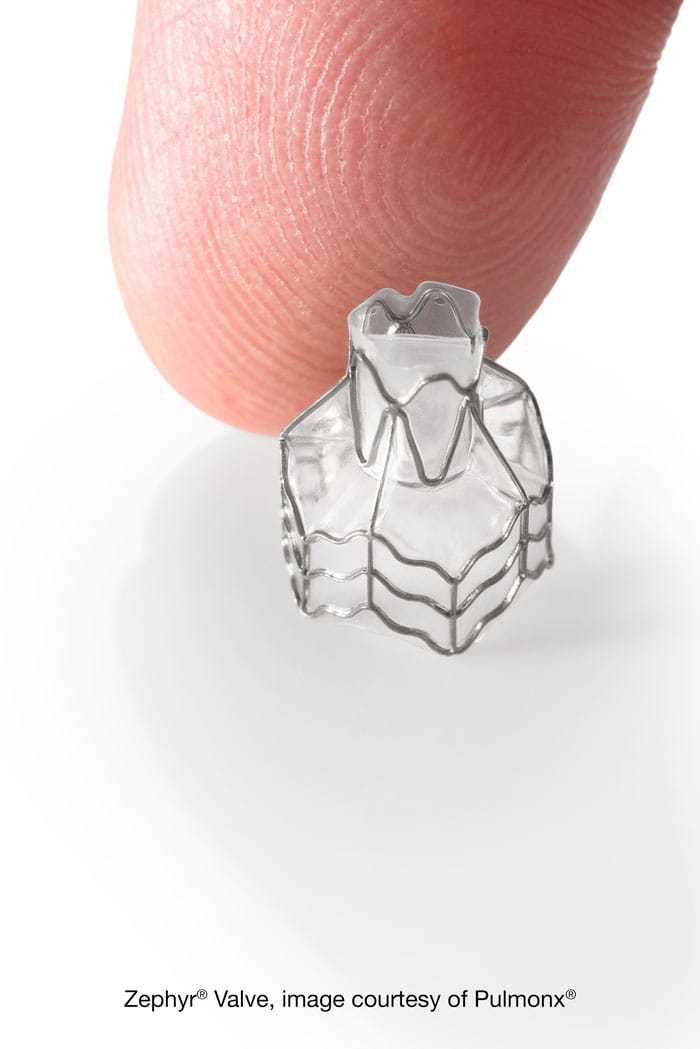 Zephyr Endobronchial Valve — FDA-approved BLVR device